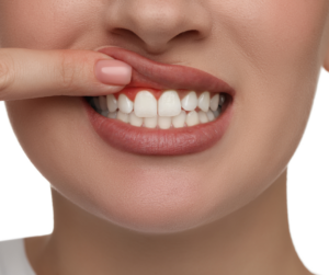 Impact of Nutrition on Gum Health