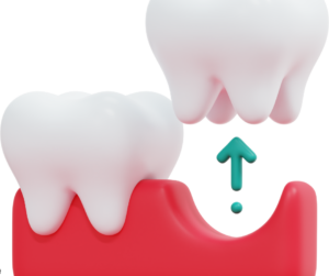 Tooth Extractions in Columbus